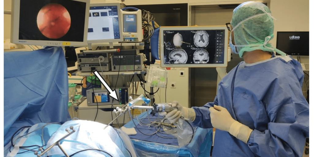 مناظير السائل النخاعي