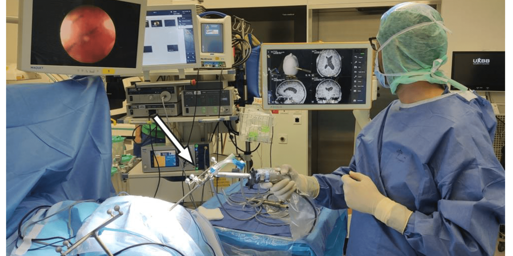 مناظير السائل النخاعي