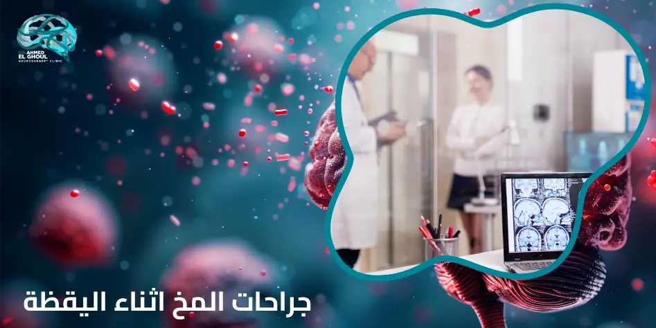 أفضل مراكز علاج أورام المخ في مصر