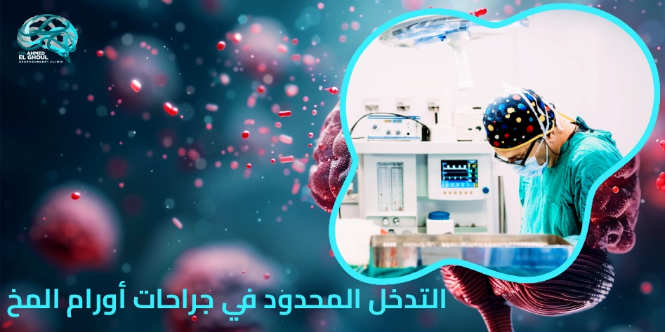 التدخل المحدود في جراحات أورام المخ