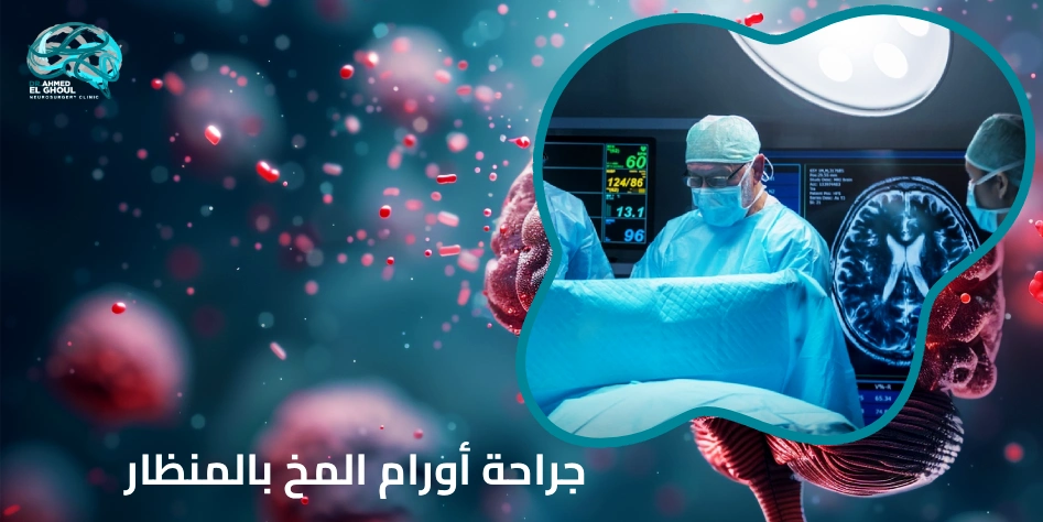 جراحة أورام المخ بالمنظار