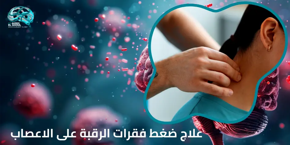 علاج ضغط فقرات الرقبة على الاعصاب
