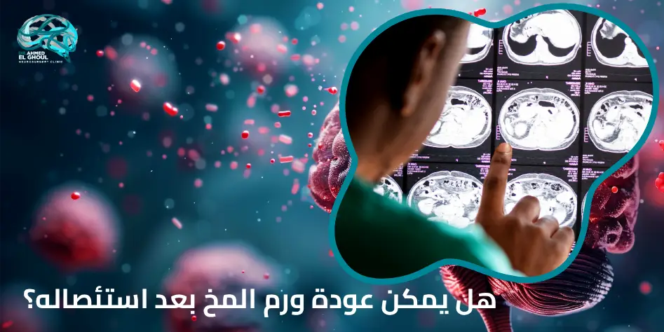 هل يمكن عودة ورم المخ بعد استئصاله؟
