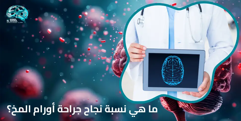 ما هي نسبة نجاح جراحة أورام المخ؟