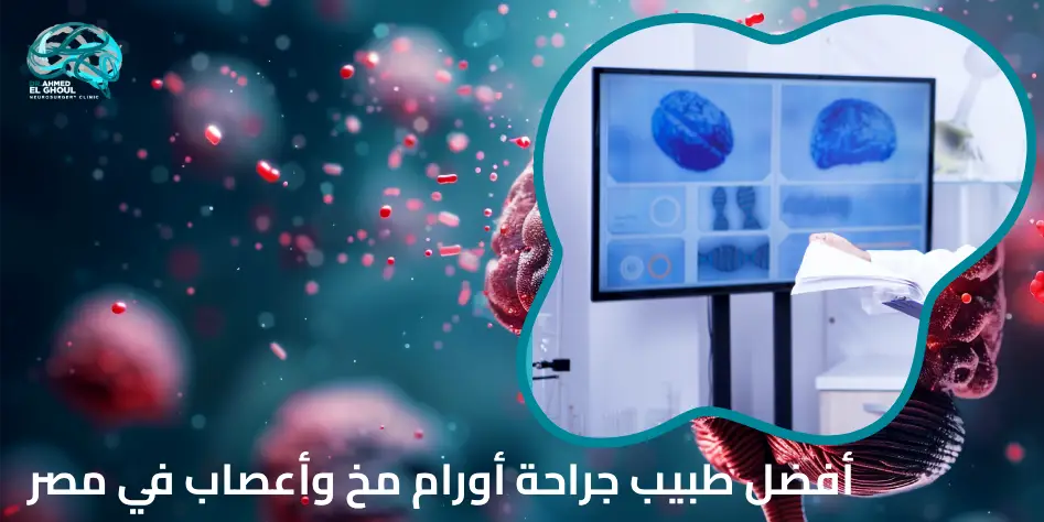 أفضل طبيب جراحة أورام مخ وأعصاب في مصر