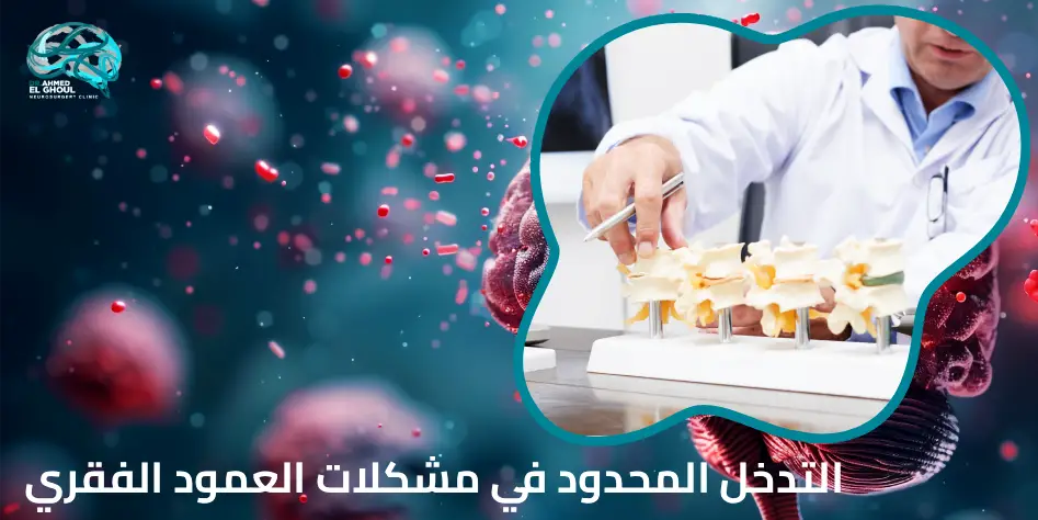 التدخل المحدود في مشكلات العمود الفقري