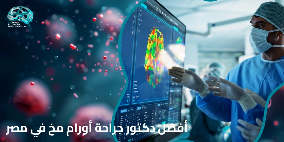 أفضل دكتور جراحة أورام مخ في مصر
