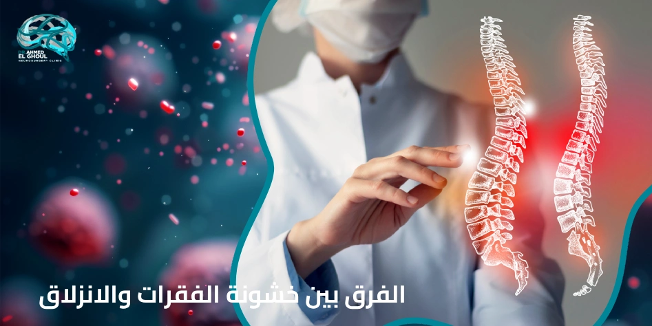 الفرق بين خشونة الفقرات والانزلاق