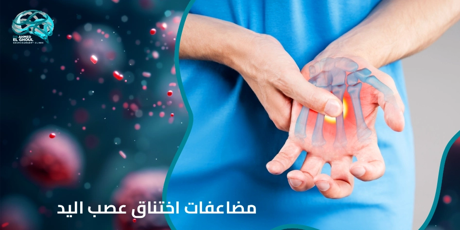 مضاعفات اختناق عصب اليد