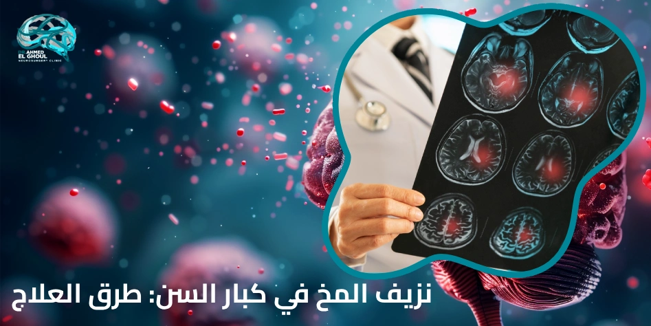 نزيف المخ في كبار السن