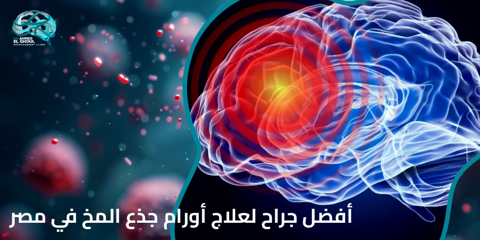 أفضل جراح لعلاج أورام جذع المخ في مصر