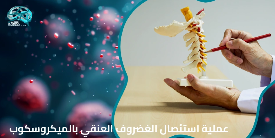 عملية استئصال الغضروف العنقي بالميكروسكوب