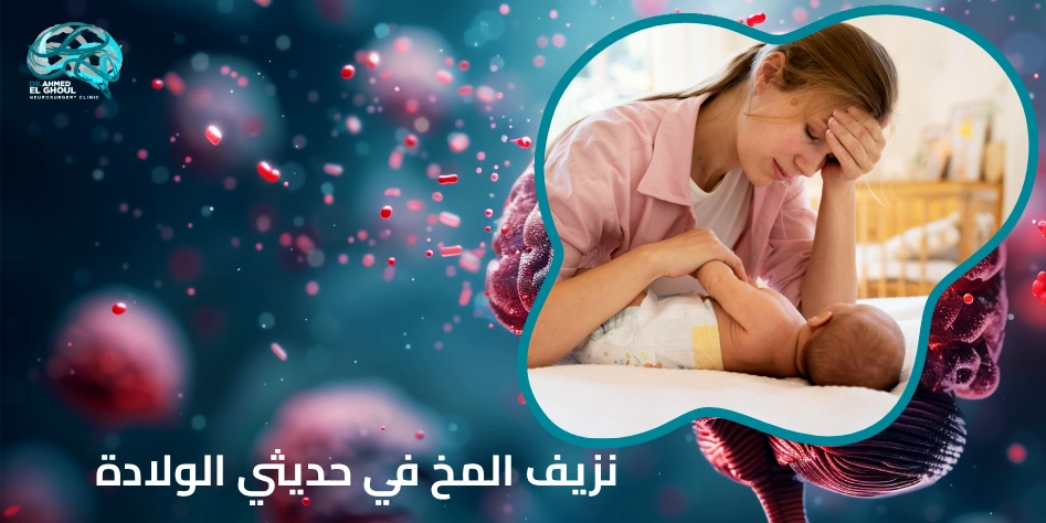 نزيف المخ في حديثي الولادة