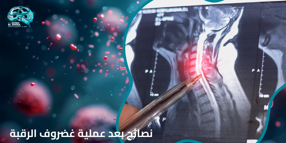 نصائح بعد عملية غضروف الرقبة