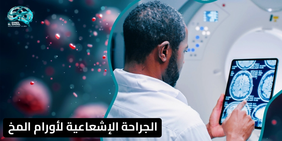 الجراحة الإشعاعية لأورام المخ
