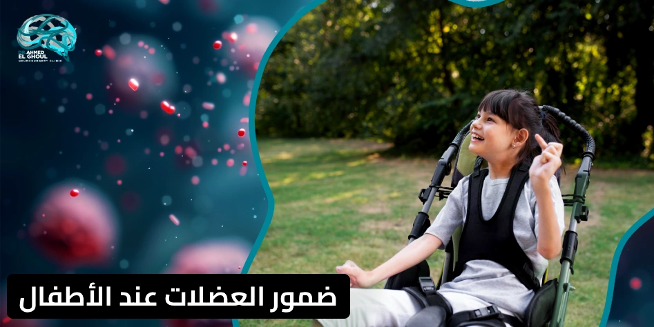 ضمور العضلات عند الأطفال