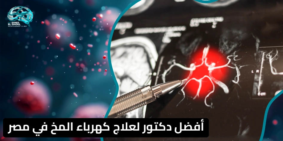 أفضل دكتور لعلاج كهرباء المخ في مصر