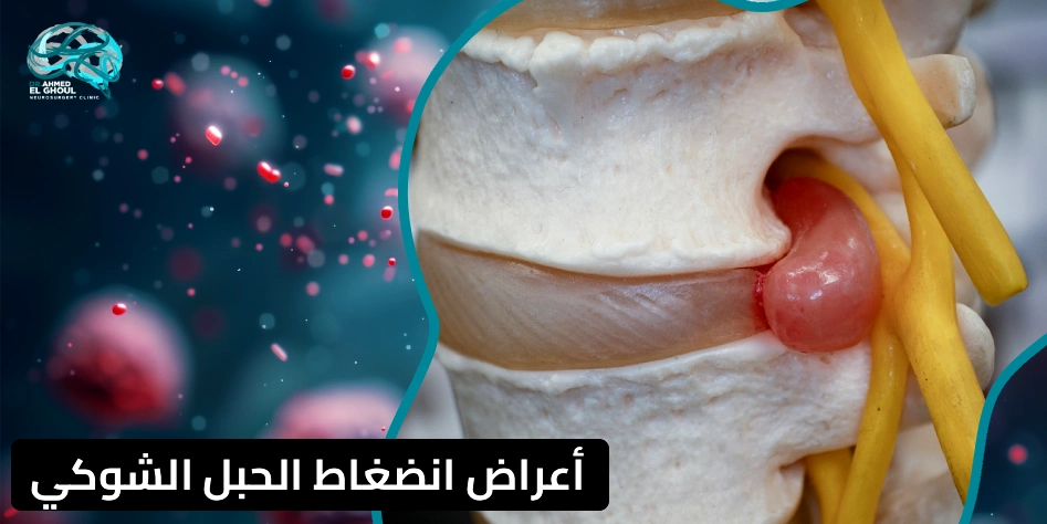 أعراض انضغاط الحبل الشوكي