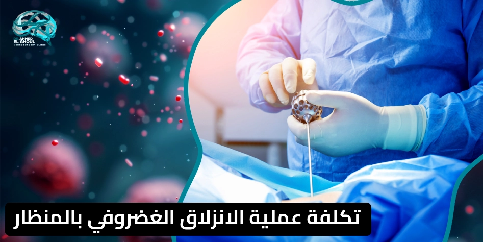 تكلفة عملية الانزلاق الغضروفي بالمنظار