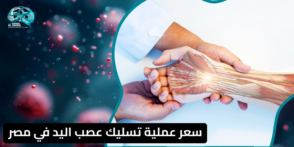 سعر عملية تسليك عصب اليد