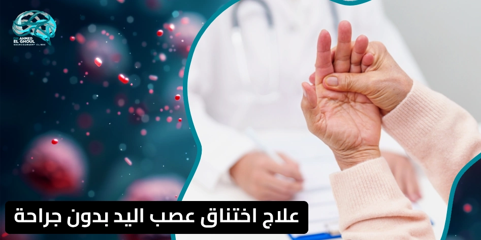 علاج اختناق عصب اليد بدون جراحة
