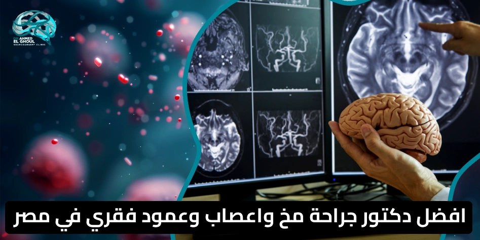 افضل دكتور جراحة مخ واعصاب وعمود فقري في مصر