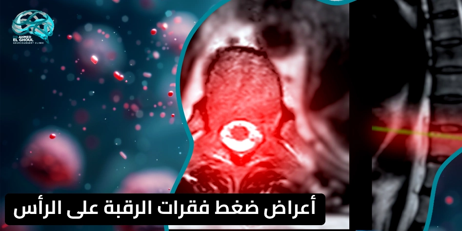 أعراض ضغط فقرات الرقبة على الرأس