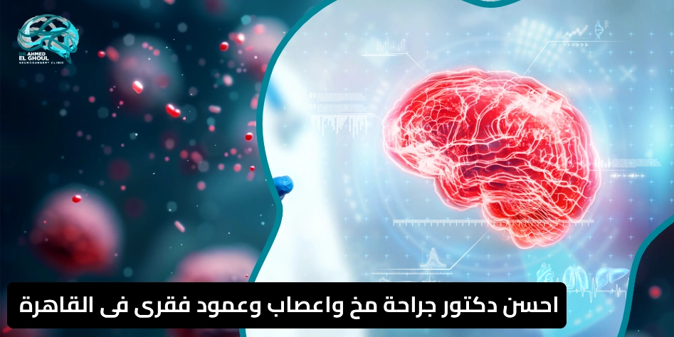 احسن دكتور جراحة مخ واعصاب وعمود فقرى فى القاهرة