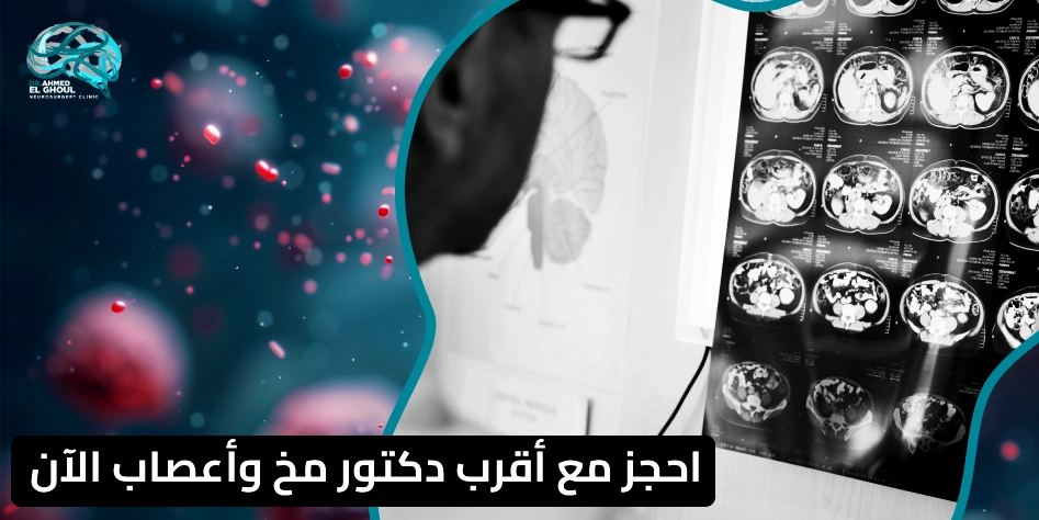 دكتور مخ واعصاب