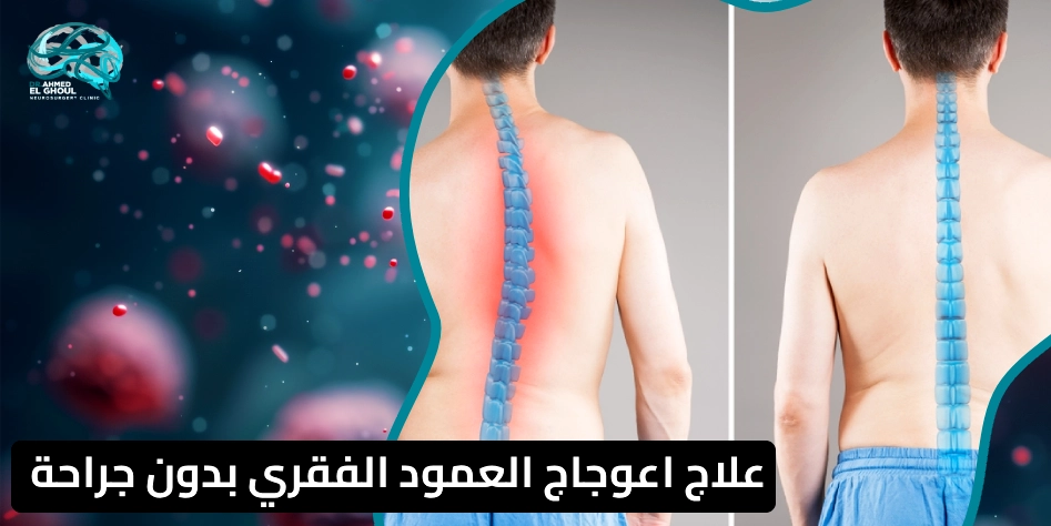 علاج اعوجاج العمود الفقري بدون جراحة